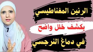 الرنين المغناطيسي يكشف وجود خلل في دماغ النرجسي، فما هو؟ وكيف نستفيد من هذا الاكتشاف؟
