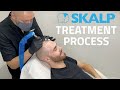 Skalp® Scalp Micropigmentation Treatment Process