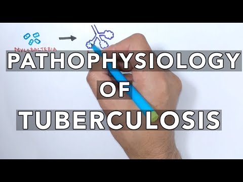 Video: Starptautisko Nevalstisko Organizāciju Sniegta Kopienas Balstīta Tuberkulozes Aprūpe Grūti Sasniedzamām Populācijām Mjanmā 2013. –