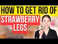 Best skincare to get rid of strawberry legs