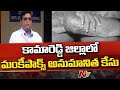 Fever Hospital Superintendent on suspected Monkeypox case