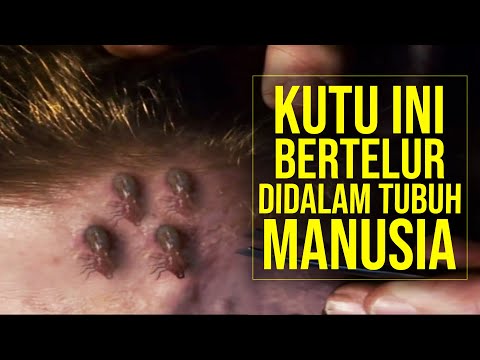 Video: Anak-anak Hidup Di Antara Kecoak Dan Kutu Busuk