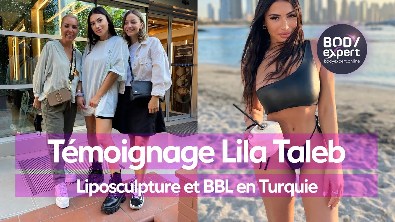 CHIRURGIE ESTHTIQUE    Tmoignage Lila Taleb  Liposculpture et BBL en Turquie  BODYEXPERT