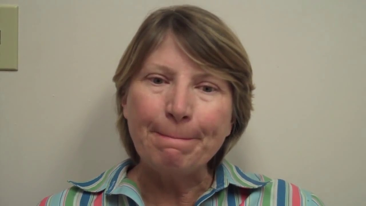 Cosmetic Surgery San Ramon | CO2 FX Fractional Resurfacing Testimonial