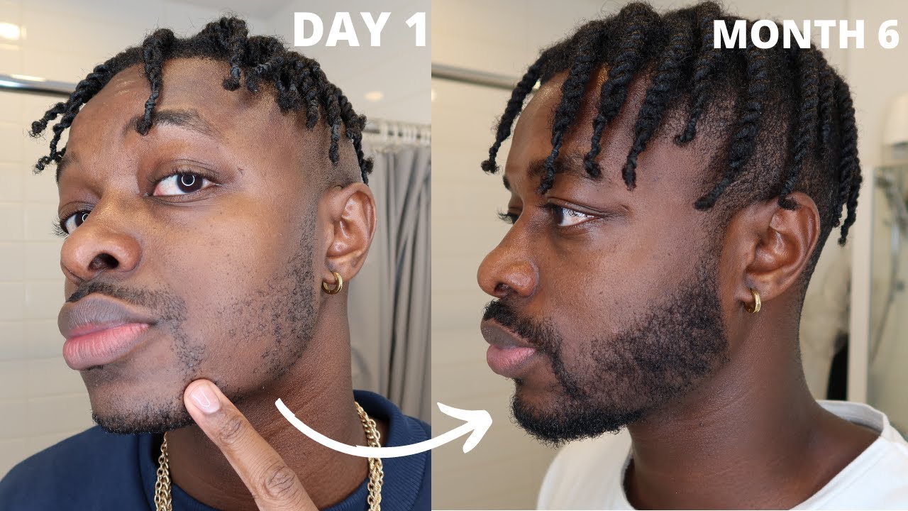 MY MINOXIDIL BEARD 6 MONTH TRANSFORMATION | WEEK 29 UPDATE - YouTube