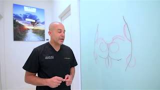 Let’s talk about #brazilianbuttlift by Dr. Goodwin at Inspire Cosmetic Surgery