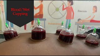 Blood/Wet Cupping
