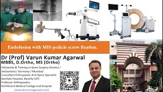 Endofusion with MIS Pedicle Screw Fixation | Advanced MISS | Dr Varun Agarwal !