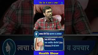Reel - हेल्थ शो | त्वचा रोग से सम्बंधित समस्याएं एवं उपचार | Health Show