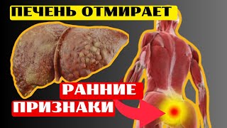 12 ранних Признаков ОТМИРАНИЯ ПЕЧЕНИ! 90% с проблемами печени даже не знают об этом🤔