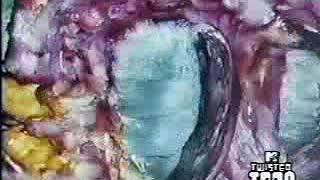 Mtv Ident - Fishbowl