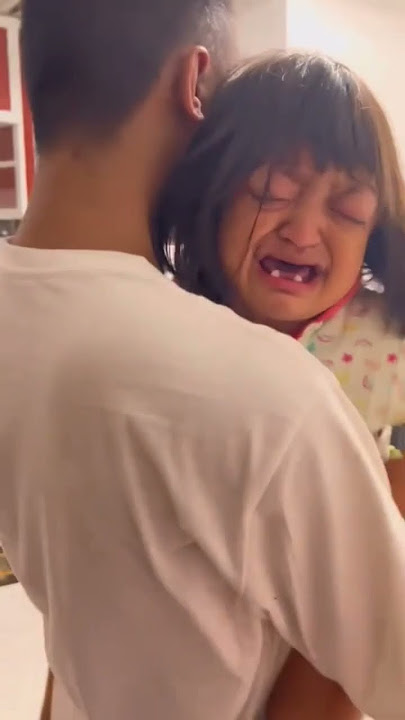 Bola Mata Bocah ini hampir lepas #shorts #viral