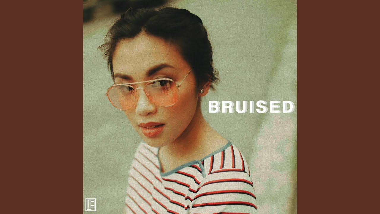 Guarda bruised su YouTube Guarda bruised su YouTube
