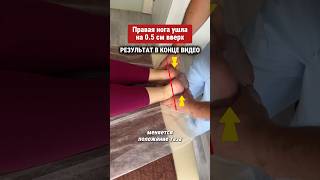 Из-за этого одна нога короче другой..