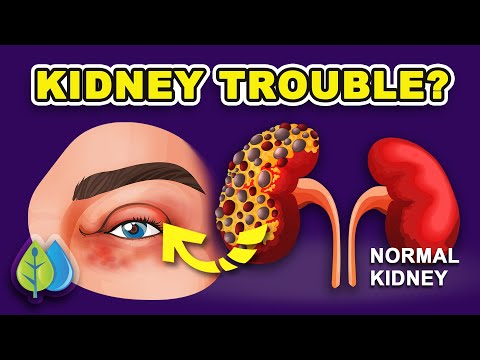 Top 10 Signs of Kidney Problems you NEED to know