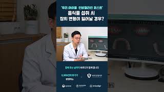 인비절라인 퍼스트, 음식물 섭취로 인해 장치가 변형됐다면? [건대 바르다교정치과] #건대치과 #건대교정치과#건대치아교정#자양동치과 #광진구치과