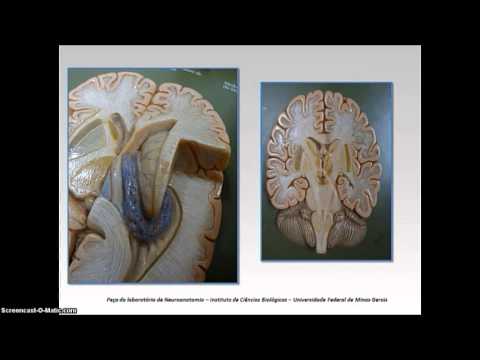 Cérebro - Ventrículos e suas adjacências