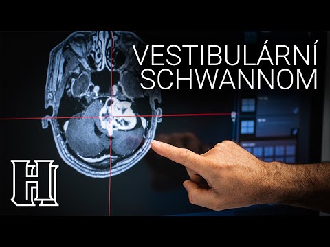 Vestibulární schwannom - neurinom akustiku - nádor sluchového nervu