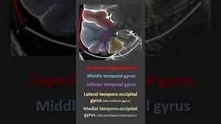 Temporal Lobe Anatomy on imaging