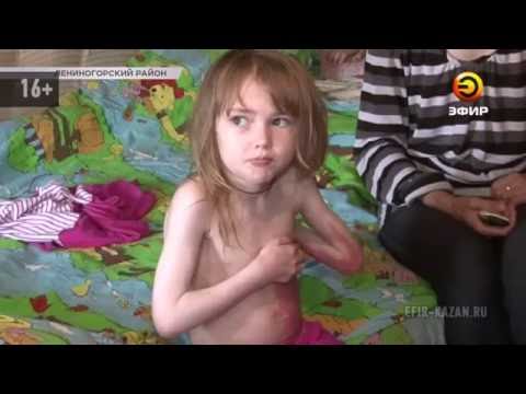 Видео: Данна Гарсия страдает от детской болезни
