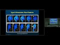 2016 Shumway Lecture: Translational Research in Aortic Disease by John S. Ikonomidis