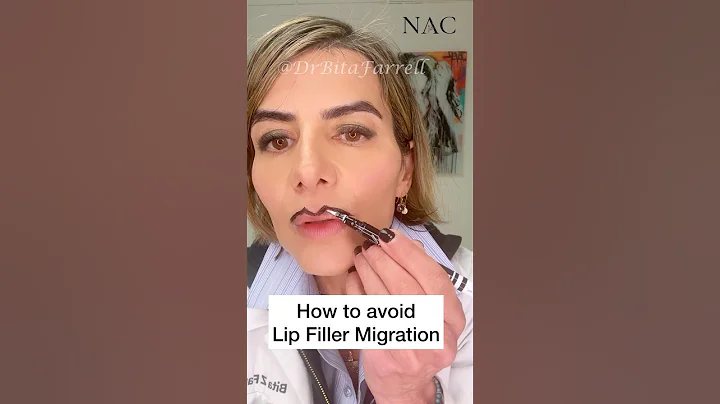 #lipfiller #lipfillermigration #fillermigration #lipfillertraining #fillertraining #drbitafarrell