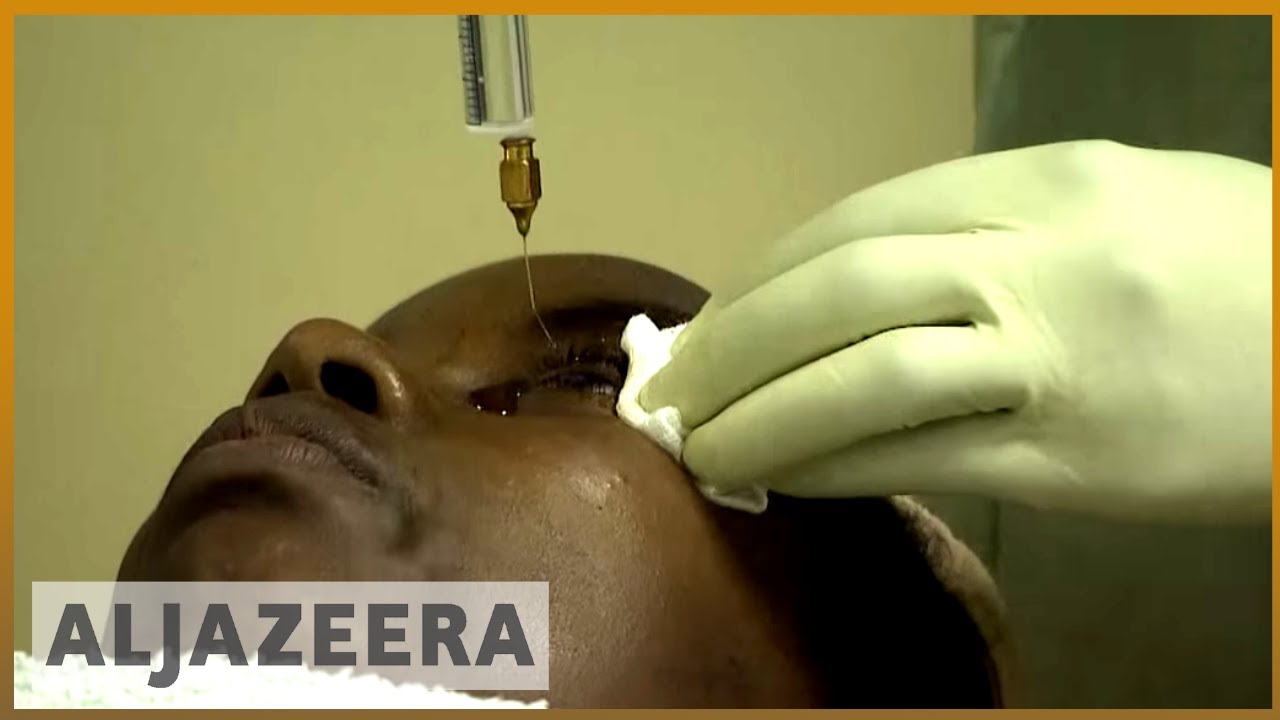 🇰🇪 نصف مليون كيني يعانون من ضعف البصر أو فقدانه كلياً | الجزيرة الإنجليزية