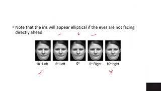 Unit-2.2: Hough Transform | Human Iris detection | Case Studies | Computer Vision & Image Processing