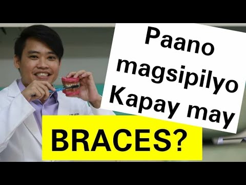 Braces! Paano Linisin at Paano ang Tamang Pagtoothbrush Nito.. #14