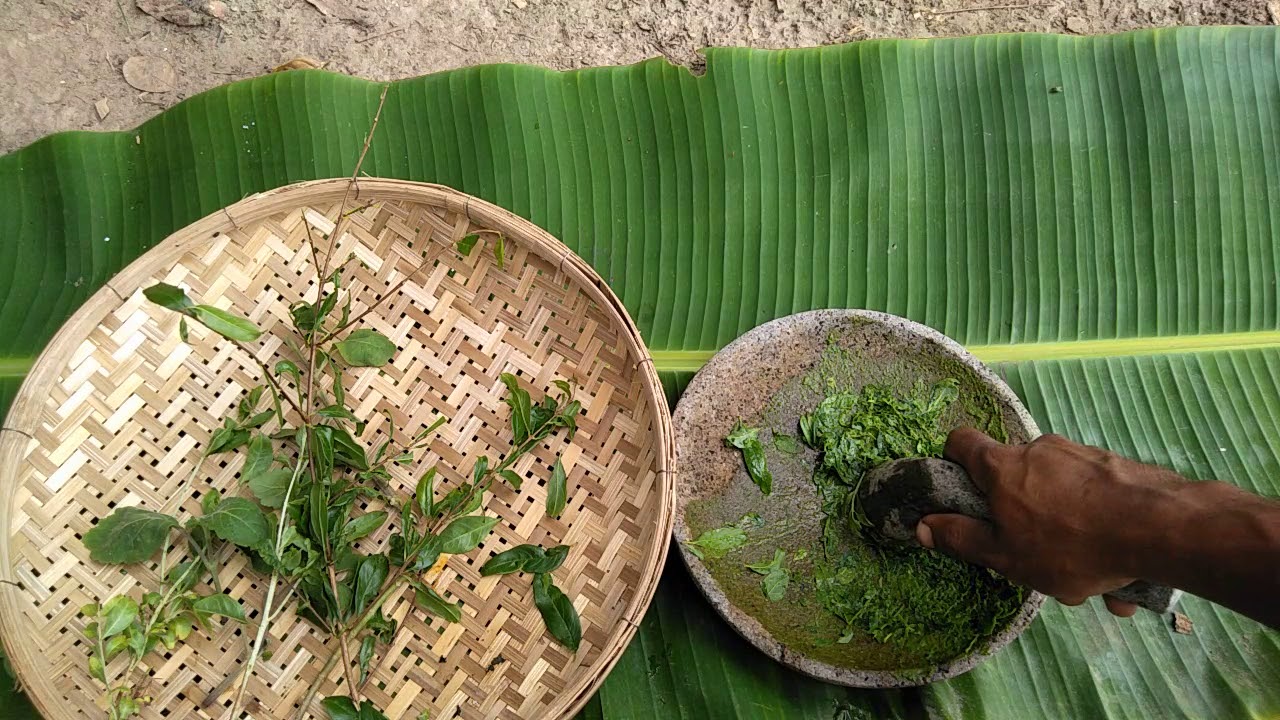 MENGOBATI BISULAN DENGAN OBAT HERBAL 