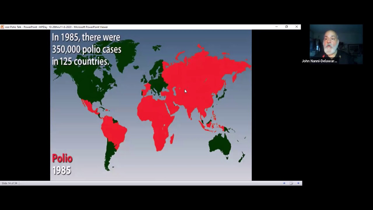 John Nanni, Polio Survivor