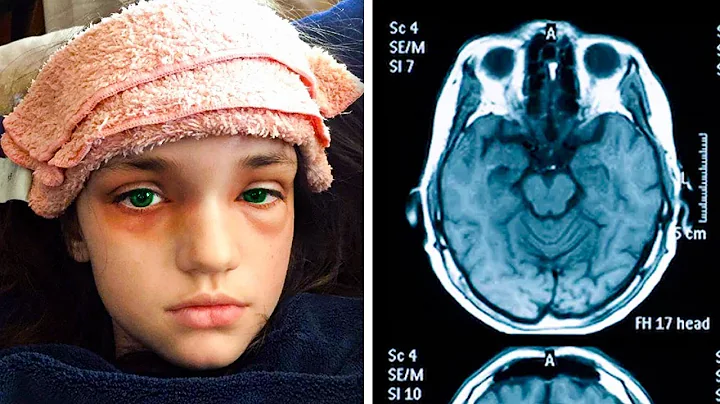 12 Year Old Athlete Took A Blow To The Head  A Sca...