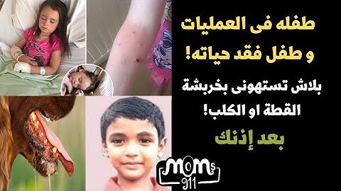 خربشة و عض الكلب او القطه لازم نتصرف معاها بسرعه بعد إذنكم