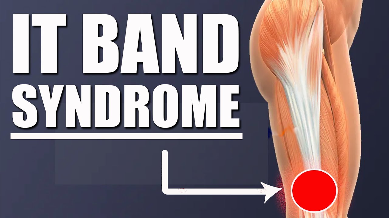 Best Stretches & Exercises for IT (Iliotibial) Band Pain Relief - YouTube