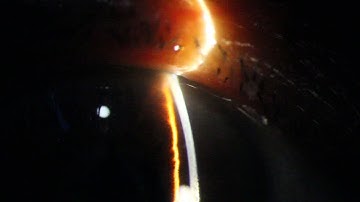 Narrow Angle Glaucoma - Van Herick Grade 0-1