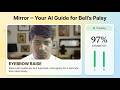 Building an AI Facial Recovery App After Bell’s Palsy