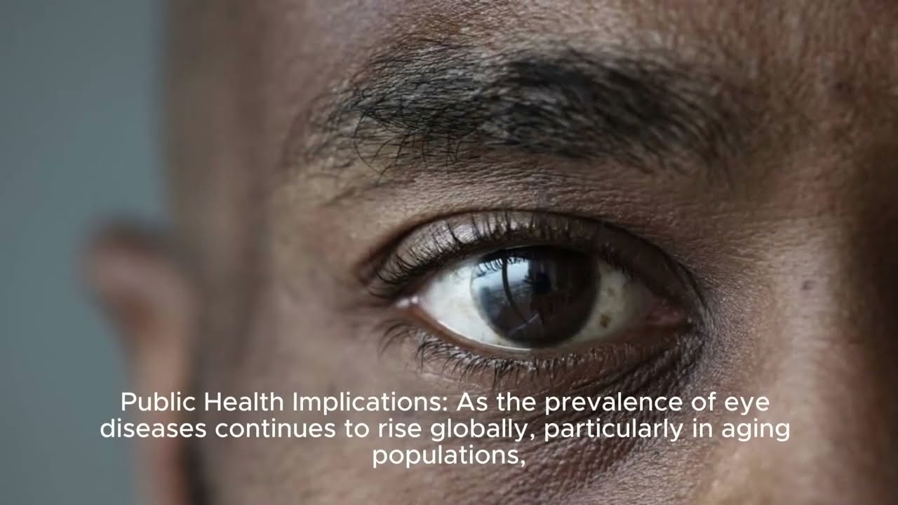 " Gut Bacteria Could Play a Role in Eye Diseases, China -UK studies find" 