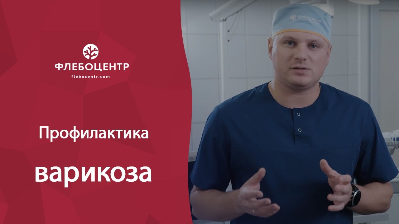 Профилактика варикоза
