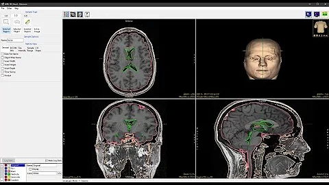 Analyze 14.0 - Measure: 2D Selected Region