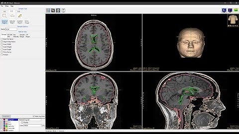 Analyze 14.0 - Measure: 2D Selected Region