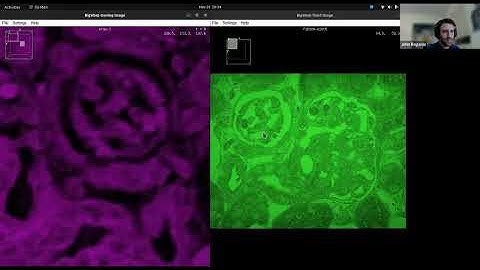 Manual image registration with BigWarp