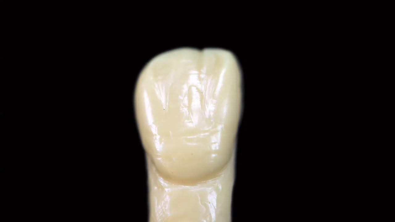 Live wax up upper lateral incisor p YouTube