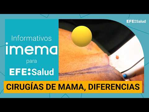 Informativo IMEMA: Reducción y elevación de mamas, ¿en qué se diferencian?