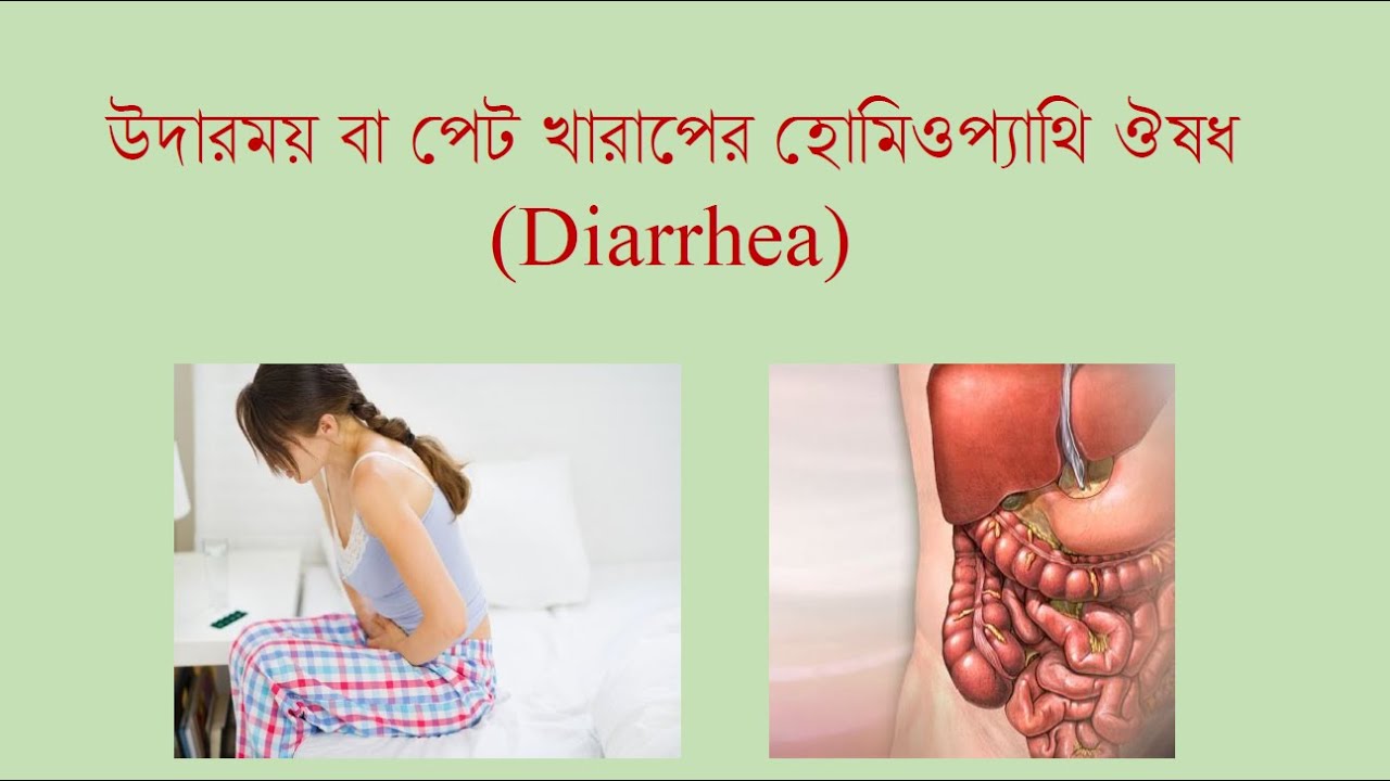ডাইরিয়ার সমস্যা ? হোমিওপ্যাথি ওষুধ Diarrhea homeopathy treatment in Bengali or Bangla
