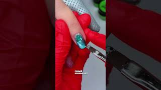 Don't Let Surgical Pins in Your Fingers Stop You From Getting a Manicure
