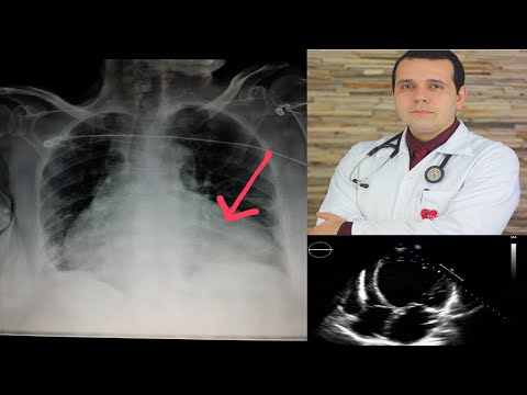 Vídeo: A ausência faz o coração crescer mais afeiçoado ou vagar?