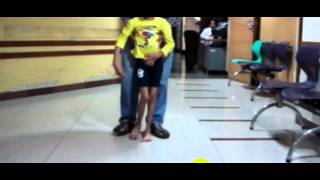 After surgery child walking with plantigrade feet and hips turned outwards