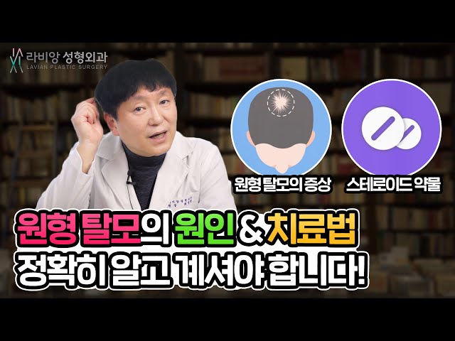 탈모 전문 성형외과 의사가 알려주는 원형탈모 원인과 치료법은?!💕