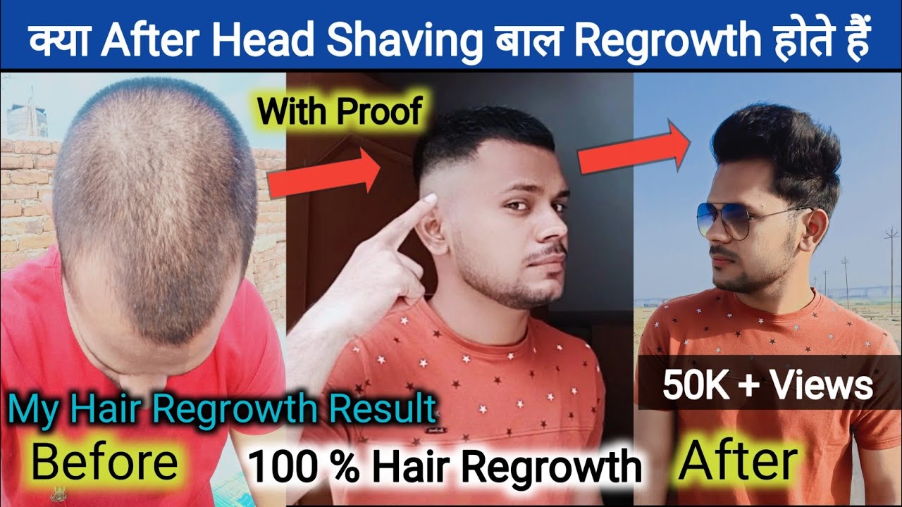 क्या After Head Shaving बाल Regrowth होते है? Hair Regrowth For Men