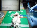 Cardiac pacemaker powered by body's own muscles developed